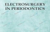 Electrosurgery in Periodontics