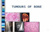 Tumours of bone clas