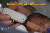 Intracranial ultrasound