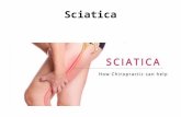 Fort Myers Sciatica Pain Relief - Chiropractor Fort Myers
