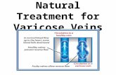 Natural treatment for varicose veins