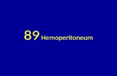89 hemoperitoneum