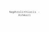 Nephrolithiasis   ashmari