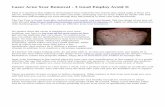 Laser Acne Scar Removal - 3 Good Employ Avoid It