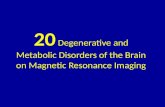20 degenerative and metabolic disorders of the brain
