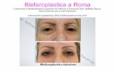 Blefaroplastica Roma | Dr. Rauso