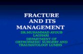 Fractures and Its Management.by Prof m Ayoub Laghari 24-4-2013
