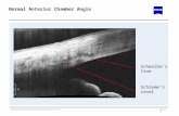 1.1 Normal Anterior Chamber Angle Schlemms canal Schwalbes line.