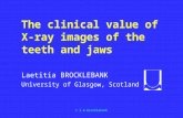 © l.m.brocklebank The clinical value of X-ray images of the teeth and jaws Laetitia BROCKLEBANK University of Glasgow, Scotland.