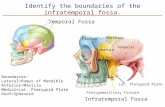 Identify the boundaries of the infratemporal fossa. Boundaries: Lateral=Ramus of Mandible Anterior=Maxilla Medial=Lat. Pterygoid Plate Roof=Sphenoid Temporal