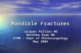 Mandible Fractures Jacques Peltier MD Matthew Ryan MD UTMB – Dept of Otolaryngology May 2004.