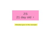 ZS 21 day old ♀ ‘Chicken pox in the neonate’. Content 1.Case presentation 2.Varicella- clinical features - differential diagnosis - treatment - complications.