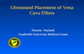 Ultrasound Placement of Vena Cava Filters Thomas Naslund Vanderbilt University Medical Center.