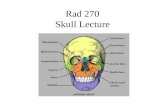 Rad 270 Skull Lecture. Skull Anatomy Comprised of 22 separate bones divided into two groups: –Cranial bones – 8 –Facial bones – 14 Cranial bones further.