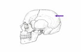 Left Parietal Bone Frontal Bone Sphenoid Bone.