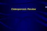 Osteoporosis Review. Osteoporosis “Silent disease” until complicated by fractures Most common bone disease in humans Characterized by: –Low bone mass.