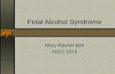 Fetal Alcohol Syndrome Mary Rachel Bell NSCI 5373.