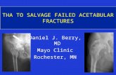 THA TO SALVAGE FAILED ACETABULAR FRACTURES Daniel J. Berry, MD Mayo Clinic Rochester, MN.