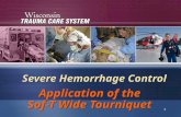1 Severe Hemorrhage Control Application of the Sof-T Wide Tourniquet.