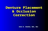 Denture Placement & Occlusion Correction Rola M. Shadid, BDS, MSc Rola M. Shadid, BDS, MSc.