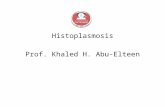Histoplasmosis Prof. Khaled H. Abu-Elteen. HISTOPLASMOSIS (Histoplasma capsulatum) Histoplasmosis is a systemic disease, mostly of the reticulo- endothelial.