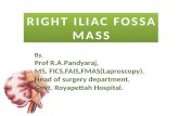 RIGHT ILIAC FOSSA MASS MASS By, Prof R.A.Pandyaraj, MS, FICS,FAIS,FMAS(Laproscopy). Head of surgery department, Govt. Royapettah Hospital.