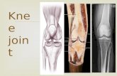 Knee joint.  The Knee Joint  Knee joint:  1- the largest joint in body  2- the most complex one { allow mobility (flexion/extension), stability(weight.