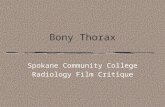 Bony Thorax Spokane Community College Radiology Film Critique.