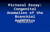 Pictoral Essay: Congenital Anomalies of the Branchial Apparatus AuthorsInstitutions.