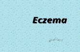 Eczema د.سهاد الجبوري. Eczema : the ward ‘eczema’derived from Greek ekzein,meaning to “to boil forth” or to “effervesce”. it Is a pattern of cutaneous.