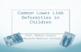 Common Lower Limb Deformities in Children Prof. Mamoun Kremli AlMaarefa Medical College.