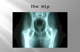 The Hip is a ball and socket joint like the shoulder, but because it is me stable it has less motion than the shoulder.