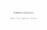 Tuberculosis Owhe Elo-Oghene Osewe. Tuberculosis This disease is caused by a microbe called mycobacterium tuberculosis. This bacterium is known to attacks.