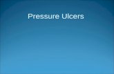 Pressure Ulcers. Pressure Ulcer Pressure ulcer – Definition Open sore caused by pressure, friction, and moisture. These factors lead to reduced blood.