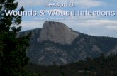 Lesson 8: Wounds & Wound Infections Emergency Reference Guide p. 75-87.
