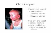 Chickenpox Causative agent –Varicella-Zoster virus –Herpes virus One of the most common rashes among children –More serious in adults.