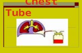 Chest Tube. Out line  Introduction  Definition  Indications  WHERE IS THE CHEST TUBE INSERTED?  Nursing skills.  Problem solving.  Removal of a.