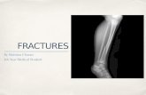 FRACTURES By Mahima Charan 4th Year Medical Student.