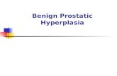 Benign Prostatic Hyperplasia. 5/18/20152 Benign Prostatic Hyperplasia Generalised disease of the prostate due to hormonal derangement which leads to enlargement.