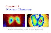 1 Chapter 11 Nuclear Chemistry Use of 131 I in detecting Hyper- or hypo- thyroidism.