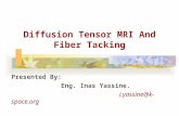 Diffusion Tensor MRI And Fiber Tacking Presented By: Eng. Inas Yassine. i.yassine@k-space.org.