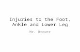 Injuries to the Foot, Ankle and Lower Leg Mr. Brewer.