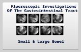 Fluoroscopic Investigations Of The Gastrointestinal Tract Small & Large Bowel.
