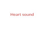 Heart sound Auscultation Stethoscopic auscultation provides the basis for identifying heart sounds, systolic and diastolic, as well as murmurs.