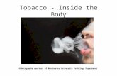 Tobacco - Inside the Body ©Photographs courtesy of Manchester University Pathology Department.