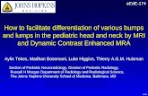 How to facilitate differentiation of various bumps and lumps in the pediatric head and neck by MRI and Dynamic Contrast Enhanced MRA Aylin Tekes, Madhan.