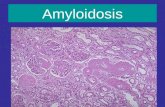 Amyloidosis. Amyloidosis of the kidney Disease LMEMIF Membranous GNThickened GBMSubepithelial Deposits Granular fl.of GBM MPGN Minimal change Focal and.