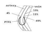 19% 11% 4% 49% vein PTFE artery. Experimental Characterization of Transitional Unsteady Flow Inside a Graft-to-Vein Junction Nurullah Arslan Mechanical.