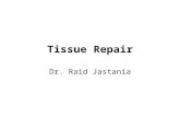 Tissue Repair Dr. Raid Jastania. What is Repair? When does regeneration occur? When does fibrosis occur? What are the consequences of fibrosis?