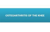 OSTEOARTHRITIS OF THE KNEE. The knee is affected by osteoarthritis more often than any other joint. The condition is particularly common in elderly, fat.